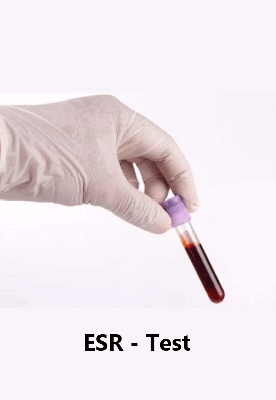 esr analyser manufacturers  in India